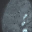 Cherry_Biotech_kidney_biopsy