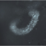 Cherry_Biotech_kidney_biopsy_3