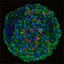 Cherry_Biotech_kidney_spheroid_cancer_on_chip