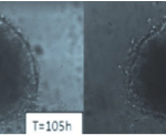 Cherry_Biotech_kidney_spheroid_cancer_on_chip_3