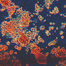 Cherry_biotech_human_biopsies_culture
