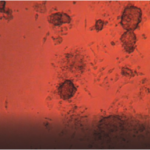 Cherry_biotech_human_biopsies_culture_2