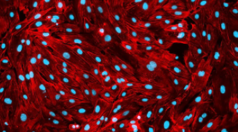 Read more about the article Isolation, Integration, and Culture of Human Mature Adipocytes Leveraging Organ-on-Chip Technology