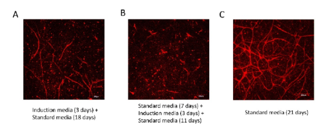 Read more about the article Adipocyte heterogeneity underlying adipose tissue functions