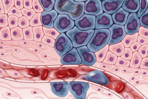 Read more about the article Tumor microenvironment (TME)