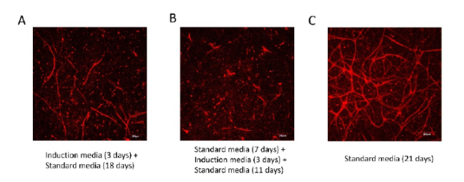 Cherry-biotech-3d-adipocyte-vascularization