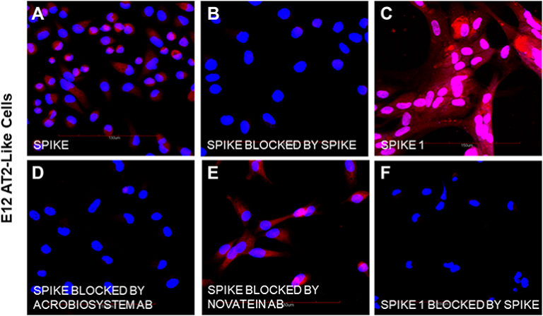 Read more about the article Binding of the SARS-CoV-2 Spike Protein to the Asialoglycoprotein Receptor on Human Primary Hepatocytes and Immortalized Hepatocyte-Like Cells by Confocal Analysis (Collins DP et al, 2021)