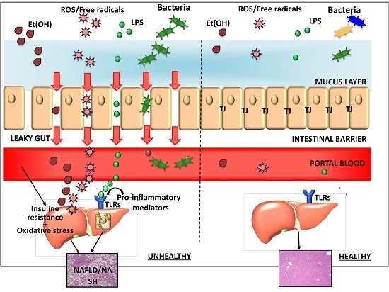 Microphysiological-system-gut-liver-axis