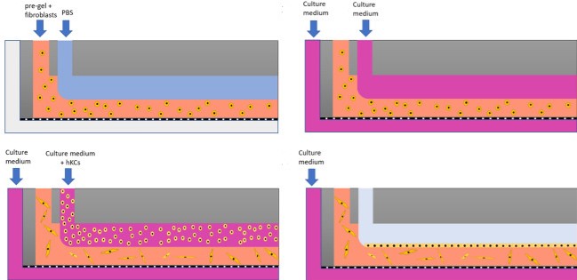 Read more about the article A new microfluidic method enabling the generation of multi-layered tissues-on-chips using skin cells as a proof of concept